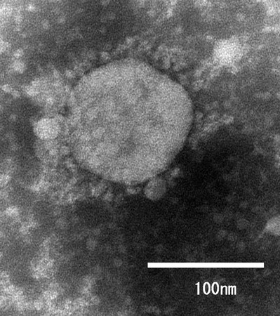電子顕微鏡で見た新型コロナウイルスの変異種の一例(国立感染症研究所提供)
