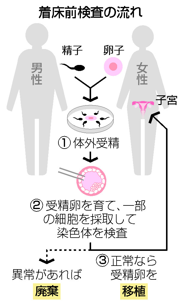 着床前検査の流れ