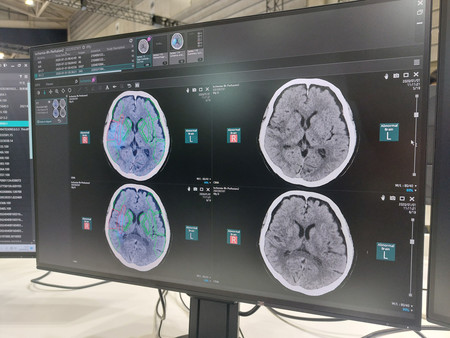 キヤノンメディカルシステムズの人工知能（ＡＩ）を活用した脳の画像診断の様子＝１２日、横浜市