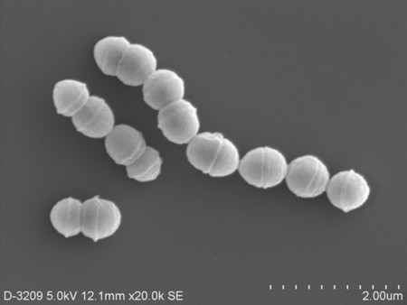 劇症型溶血性レンサ球菌感染症（ＳＴＳＳ）の原因となるＡ群溶連菌（国立感染症研究所提供）