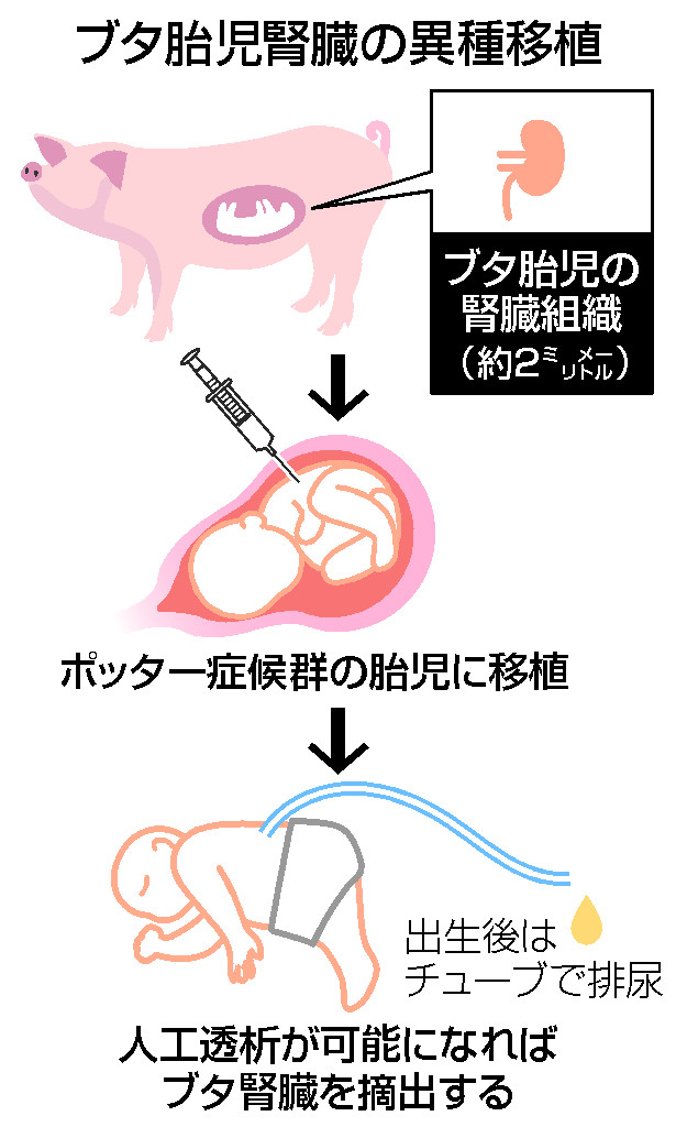 ブタ胎児腎臓の異種移植